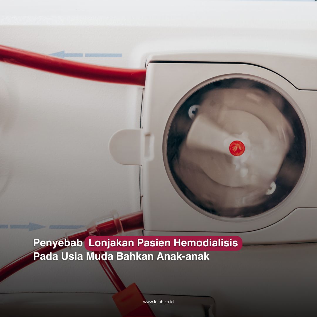 Ketika ginjal tak lagi berfungsi optimal, hemodialisis menjadi penyelamat. Proses ini membantu menggantikan peran ginjal dalam menyaring racun. Simak penjelasannya di gambar atas! ⬆️💙
#Gingal #Kesehatan #Hemodialisis
