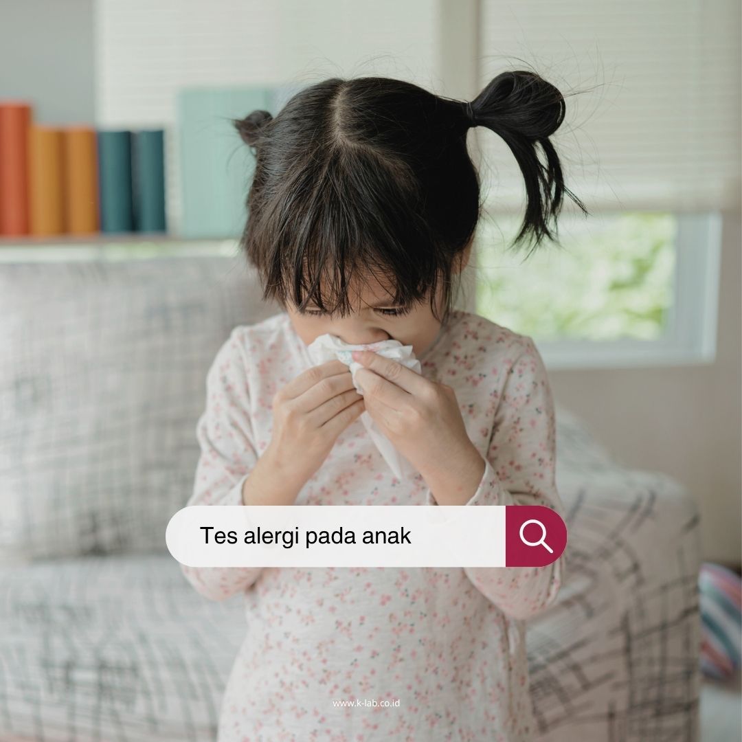 🧐 Alergi? terjadi ketika sistem kekebalan tubuh Anda beraksi berlebihan terhadap zat asing seperti serbuk sari, bulu hewan atau makanan yang memicu sistem kekebalan tubuh Anda melepaskan antibodi yang disebut imunoglobulin E untuk melepas histamin.
Gejala alergi:
✅ Reaksi kulit (Gatal, biduran dll)
✅ Kesulitan bernapas
✅ Muntah
✅ Diare
✅ Anafilaksis, yang merupakan reaksi parah dan mengancam jiwa
Saatnya lindungi si kecil dari alergi sedini mungkin! ❤️ Tes alergi anak di K-Lab mampu mendeteksi hingga 108 jenis alergen, mulai dari makanan, debu, bulu hewan dan lainnya ✨
Hubungi klinik kami melakui nomor whatsapp di 081381367915 😊
#TesAlergiAnak #CekAlergi