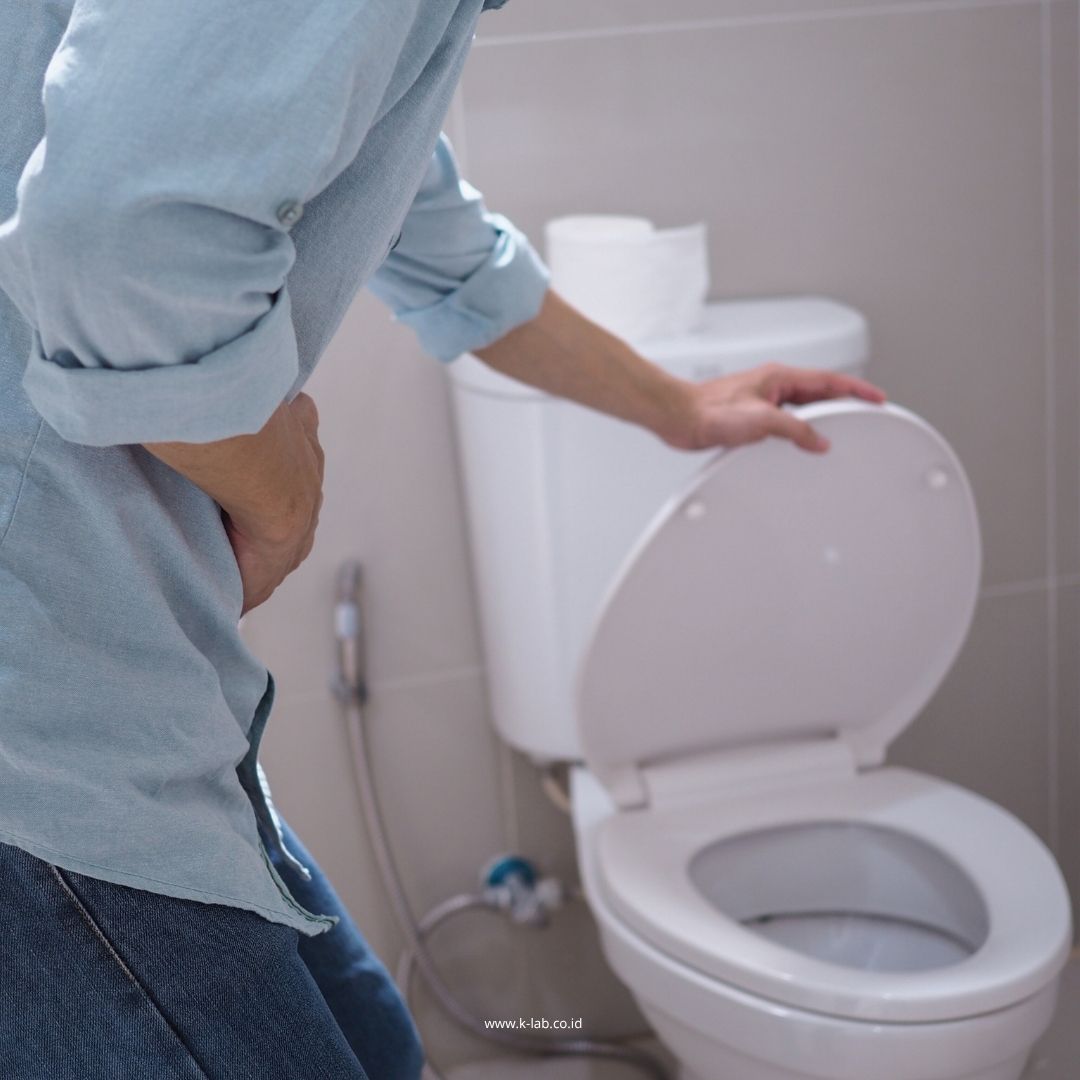 Frekuensi buang air kecil kamu meningkat? 😱 ditambah kamu suka sekali makan minum manis 🍩🥤
Ciri-ciri diabetes di usia muda:
🔸 Sering buang air kecil
🔸 Sering terasa haus
🔸 Berat badan turun drastis
🔸 Kulit dan mulut yang kering
🔸 Mudah lelah
🔸 Pandangan kabur
🔸 Luka sulit sembuh
🧐 Apa itu diabetes?
Diabetes adalah penyakit kronis yang ditandai dengan tingginya kadar gula di dalam darah. Glukosa atau gula adalah sumber energi utama bagi tubuh. Namun, pada penderita diabetes, glukosa tidak dapat digunakan oleh tubuh dengan efektif 😟
✨👩⚕️ Yuk, jangan tunggu sampai terlambat! Cegah risiko diabetes sejak dini dengan tes diabetes hanya Rp249.000! 🫶 🧬
📲 Booking sekarang lewat WhatsApp ya: 0813 8136 7915
Ingat menjaga kesehatan bukan soal menunggu sakit, tapi soal mencegah sebelum terlambat ❤️
#BeraniSehat #Promo #Klinik #Kesehatan