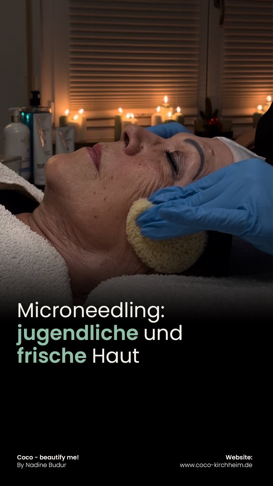 Suchst du nach einer Hautpflegebehandlung, die die Kollagen- und Elastinproduktion steigert und deine Hautstruktur verbessert? Dann ist das Microneedling genau das Richtige für dich!
Beim Microneedling werden durch feine Nadelstiche kleine Verletzungen in der Haut erzeugt, wodurch die Hautzellen angeregt werden, sich zu regenerieren und neues Kollagen zu bilden. Das Ergebnis ist eine strahlende, straffe und gesunde Haut. ✨
Microneedling hilft nicht nur bei feinen Linien und Falten, sondern kann auch das Erscheinungsbild von Narben, Aknenarben und Hyperpigmentierung reduzieren. Außerdem ist es für alle Hauttypen geeignet.
Bei Coco bieten wir Microneedling-Behandlungen an, die auf deine spezifischen Hautpflegebedürfnisse zugeschnitten sind. Unsere erfahrenen Kosmetikerinnen verwenden die neuesten Technologien, Techniken und Produkte, um optimale Ergebnisse zu erzielen, damit du dich in deiner Haut selbstbewusst und erfrischt fühlst.
Dauer: Ab einer Stunde
Preis: 150€
💡 Übrigens: Auch Geheimratsecken am Haaransatz oder flächenweise Haarausfall können mit dieser Methode behandelt werden. Dauer und Preis richten sich nach Größe des Areals.
🌿 Warte nicht länger, um dir ein bisschen Selfcare zu gönnen. Vereinbare noch heute einen Termin für eine Microneedling-Behandlung.
Coco - beautify me!
By Nadine Budur
Termine vereinbaren am besten per
WhatsApp/SMS/E-Mail.
Falls ihr uns telefonisch nicht erreicht, hinterlasst eine Nachricht auf der Mailbox und wir melden uns:
0176 626 586 20
Unsere Adresse:
Plochingerstraße 95, 73230 Kirchheim Teck
Website: www.coco-kirchheim.de
#Microneedling #Hautpflege #GesundeHaut #Selbstpflege #Kosmetikerin #Dermatologie #Kollagenboost #Stuttgart #Antiaging #Aknebehandlung #Narbenentfernung #Hyperpigmentierung #selbstliebe