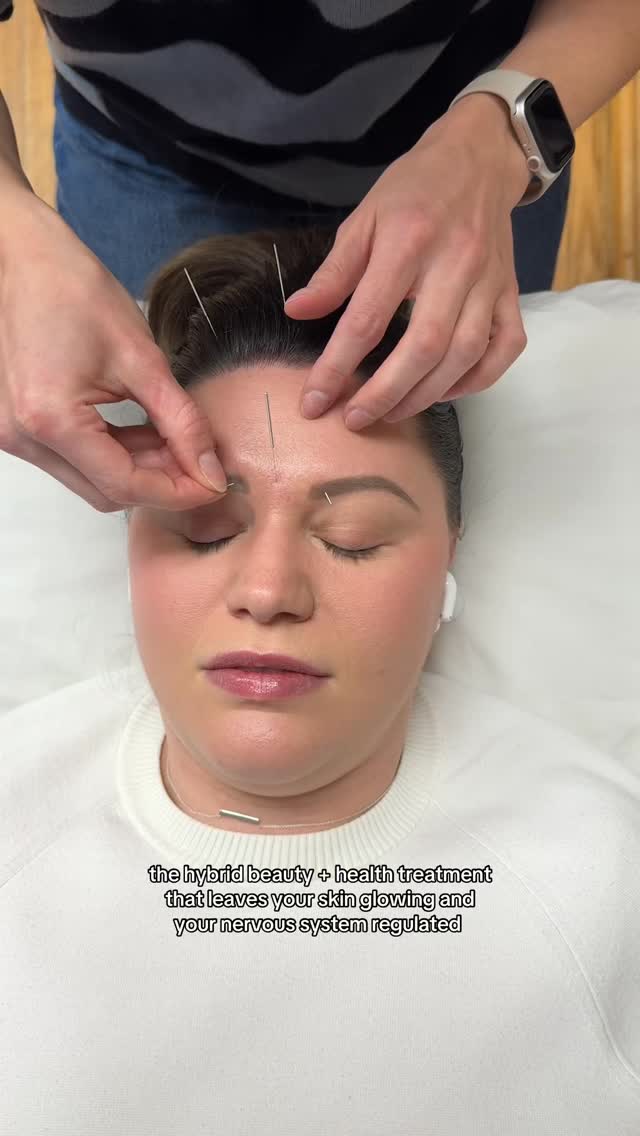 name another treatment that blends beauty + health all into one? I’ll wait…
#facialacupuncture #cosmeticacupuncture #acupuncture #acupuncturist #chinesemedicine