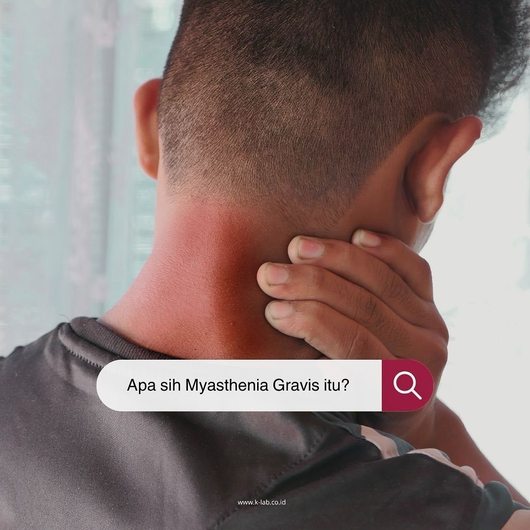 🧠💪 Tahukah kamu? Setiap 2 Juni diperingati sebagai Hari Myasthenia Gravis Sedunia! 🌍💚 Myasthenia Gravis (MG) adalah gangguan autoimun langka yang menyebabkan otot-otot tubuh menjadi lemah dan mudah lelah 😰 Cek penjelasan detailnya tentang Myasthenia Gravis di atas ya… ✨
Meski belum ada obat yang benar-benar menyembuhkan, deteksi dini dan perawatan yang tepat bisa membantu penderita menjalani hidup dengan lebih nyaman dan produktif 💚
Yuk, kut sebarkan kesadaran tentang MG! Karena semakin banyak yang tahu, semakin cepat pula kita bisa bantu 💡
#Myasthenia #DeteksiDini #Kesehatan