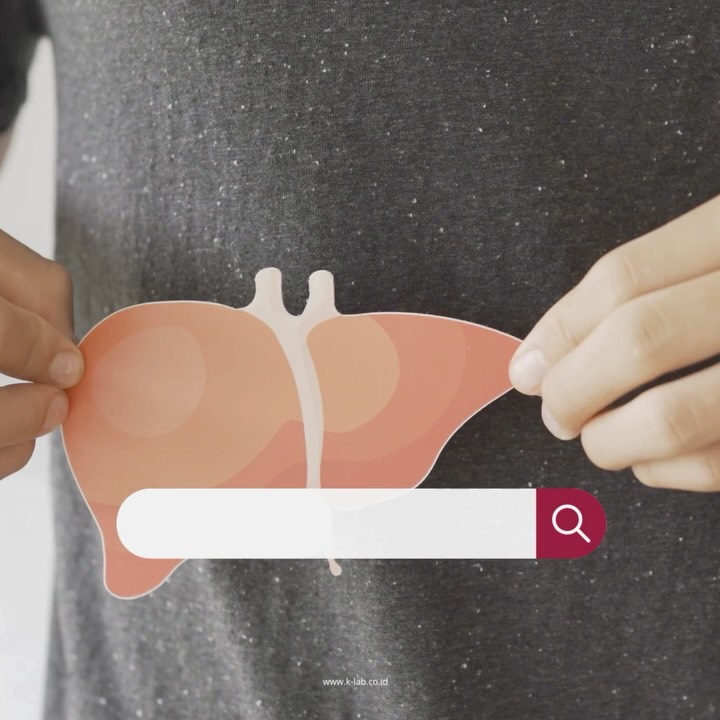 🧬 Ingin tahu kondisi hati tanpa harus disuntik atau biopsi?
Tes M2BPGi (Mac-2 Binding Protein Glycosylation isomer) adalah solusi modern untuk deteksi fibrosis hati tanpa prosedur invasif.🩸Hanya dengan sampel darah, tes ini mampu:
✔️ Menilai tingkat kerusakan hati
✔️ Mendeteksi risiko sirosis lebih awal
✔️ Memantau progres terapi hati
💡 Jangan lupa untuk selalu menjaga kesehatan hati Anda lebih awal ya! 🫶
#PemeriksaanHati