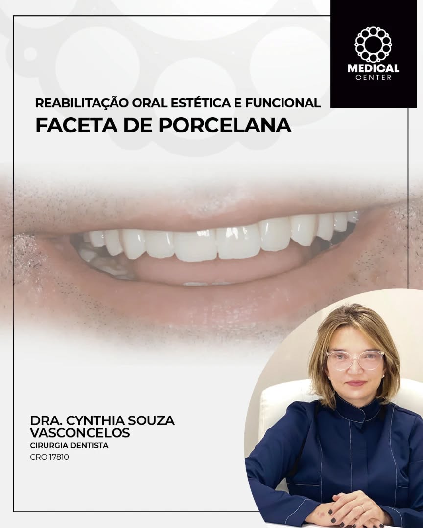 ✨ Sorrir com confiança é também uma forma de bem-estar.
A reabilitação oral estética e funcional com facetas de porcelana vai muito além da estética. É sobre devolver conforto, harmonia e segurança ao sorriso, respeitando a individualidade de cada paciente.
Com técnica, cuidado e atenção aos detalhes, a Dra. Cynthia Souza Vasconcelos, cirurgiã-dentista, realiza tratamentos personalizados que unem estética e função, promovendo resultados naturais e duradouros.
Aqui, cada sorriso é tratado com respeito, sensibilidade e profissionalismo.
📍 #VemEstarBem na #MedicalCenter.
www.medicalcenterpa.com.br
📲 Tel.: 3647-3550
📲 Térreo: 35 99830-8576
📲 1º Andar: 35 99984-5366
📲 2º Andar: 35 99867-2564
📲 3º Andar: 35 99723-7519
👉 Rua Coronel Brito Filho, 461/469 . Bairro Fátima I . Pouso Alegre . MG
#Odontologia #FacetaDePorcelana #ReabilitaçãoOral #SorrisoComConfiança