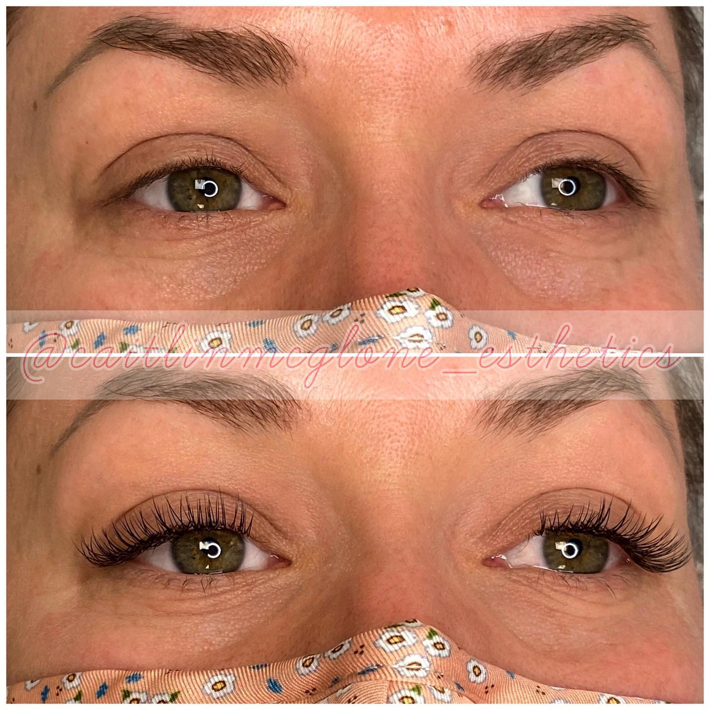 Low maintenance mornings ahead for Katie! No lash curler, no mascara... not like you can get these results with those anyways! 🙅♀️
Lash extensions are a game changer 🙌🏻
Classic Lash Full Set, 1 extension to one natural lash, mimicking the look of mascara but like, way, WAY better. 
